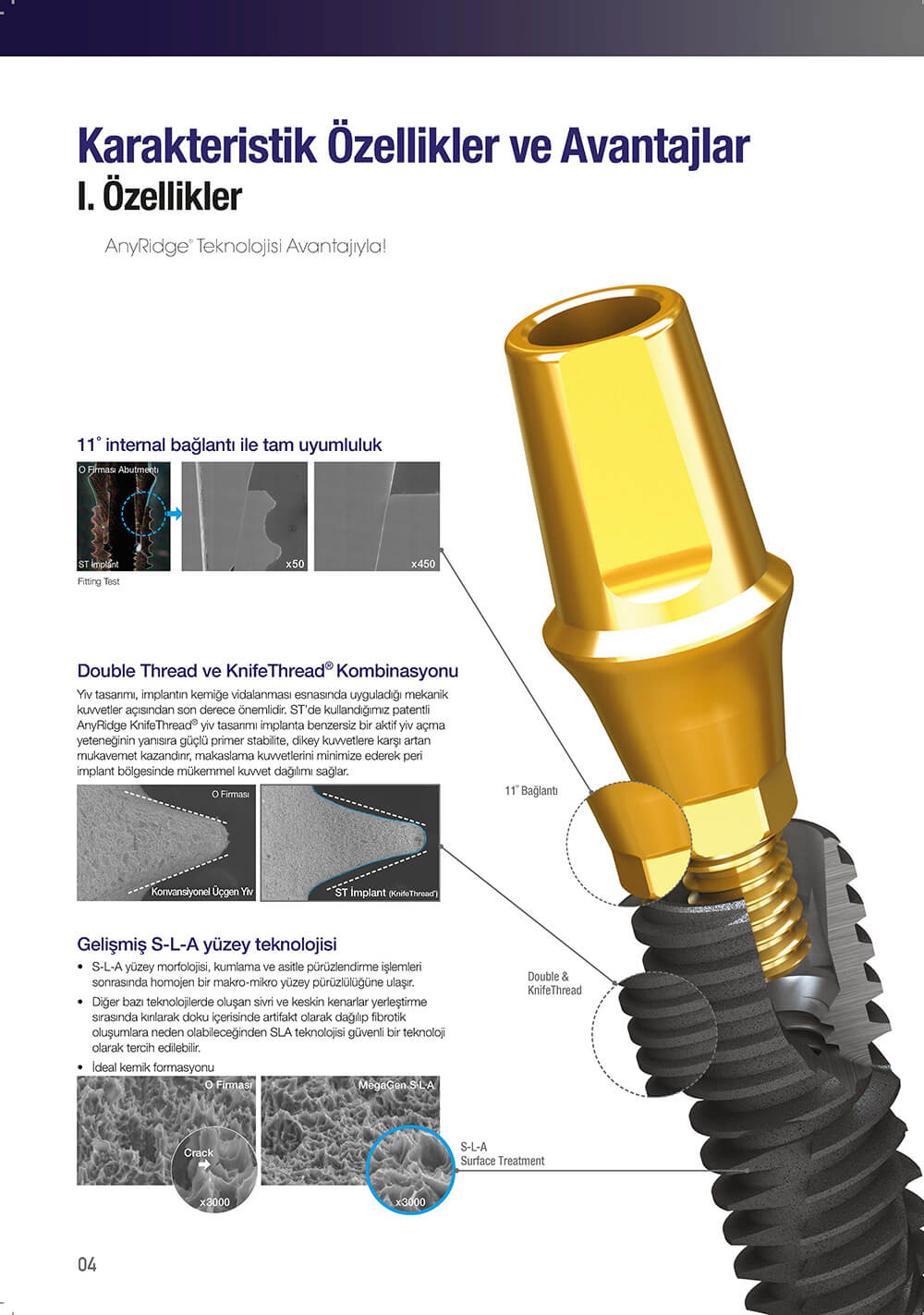 megagen-st-implant-1